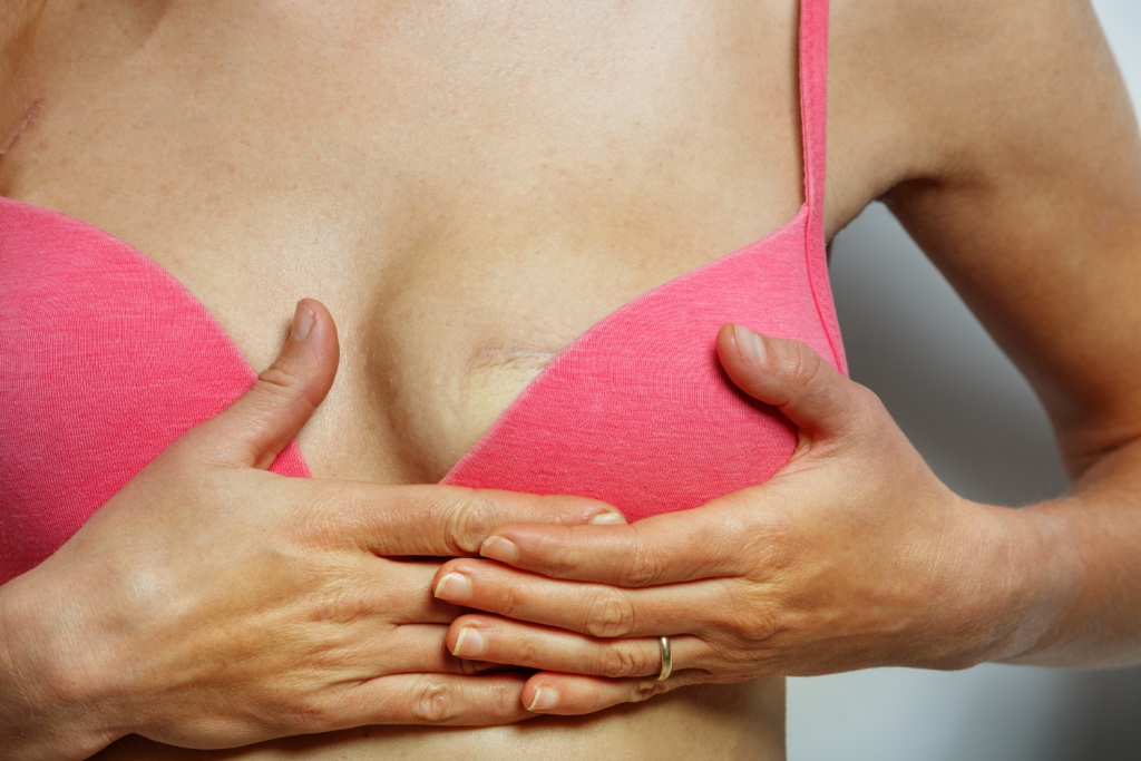 Immagine illustrativa dedicata al percorso di ricostruzione dell’areola mammaria